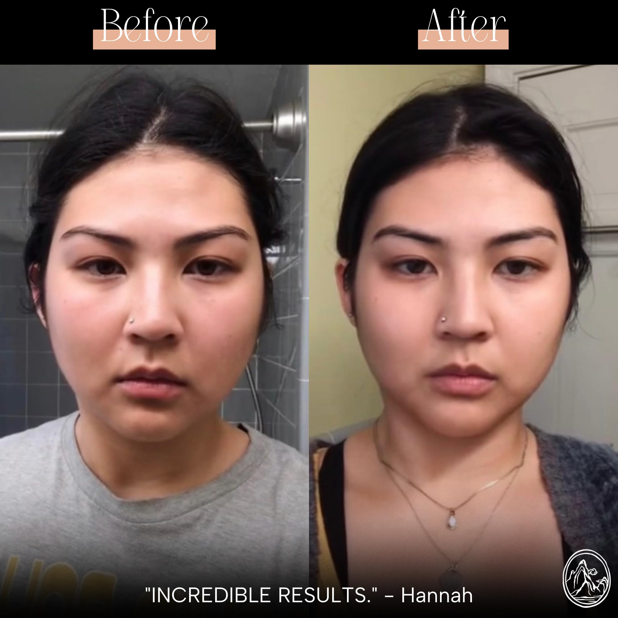 Mount Lai pierre obsidienne pour soin du visage, ritualisation avec chaleur et concentration.