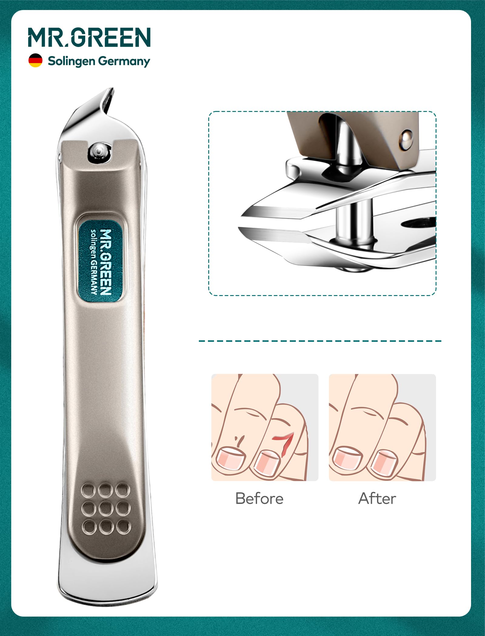 MR.GREEN pince-ongles : outil fiable pour des retouches d’ongles précises.