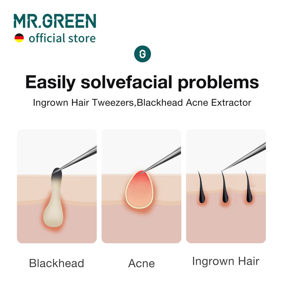 MR.GREEN pinces points noirs favorisent l extraction controlee des impuretes