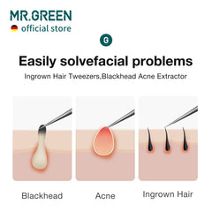MR.GREEN pinces points noirs favorisent l extraction controlee des impuretes