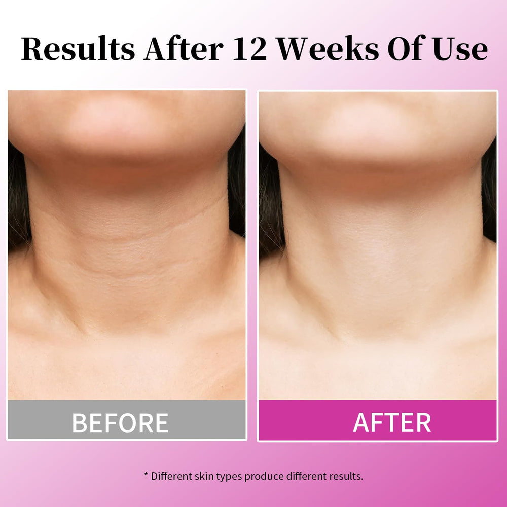 MRLILEI Beauty Crème Cou 4 en 1 – avant-apres, potentiel raffermissement du décolleté.
