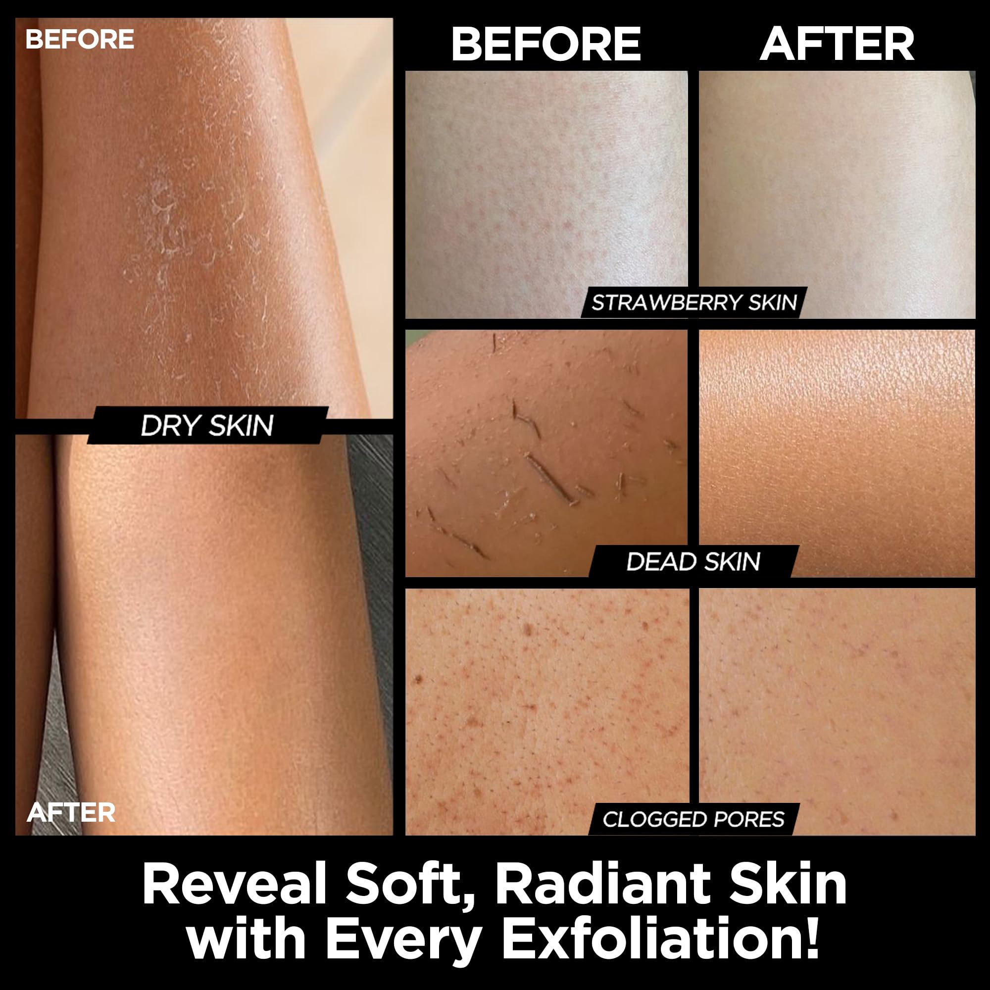 MS gant exfoliant Kessa noir offre une exfoliation efficace des couches superficielles