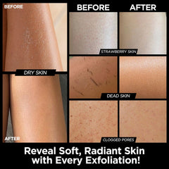 MS gant exfoliant Kessa noir offre une exfoliation efficace des couches superficielles