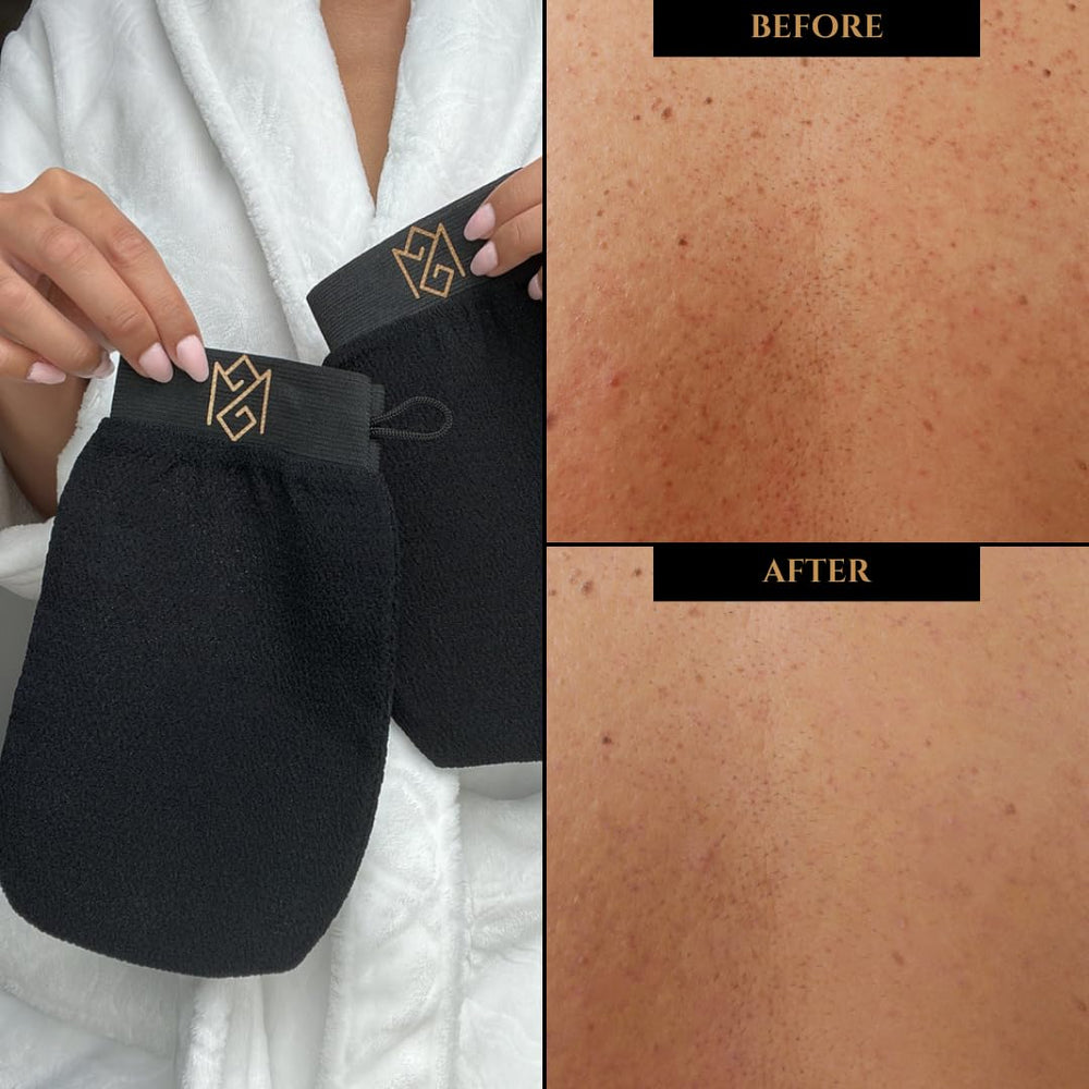 Détail des pores resserrés après l’utilisation du gant exfoliant.