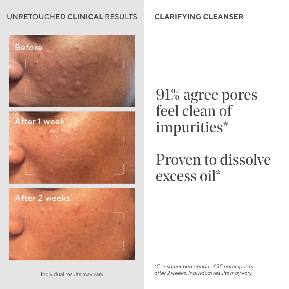 Murad Acne Control Clarifying Cleanser — purification des pores en profondeur