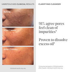 Murad Acne Control Clarifying Cleanser — purification des pores en profondeur