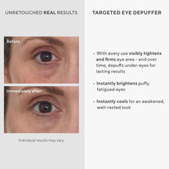 Murad applicateur refroidissant — embout métallique pour masser et rafraîchir le contour des yeux.
