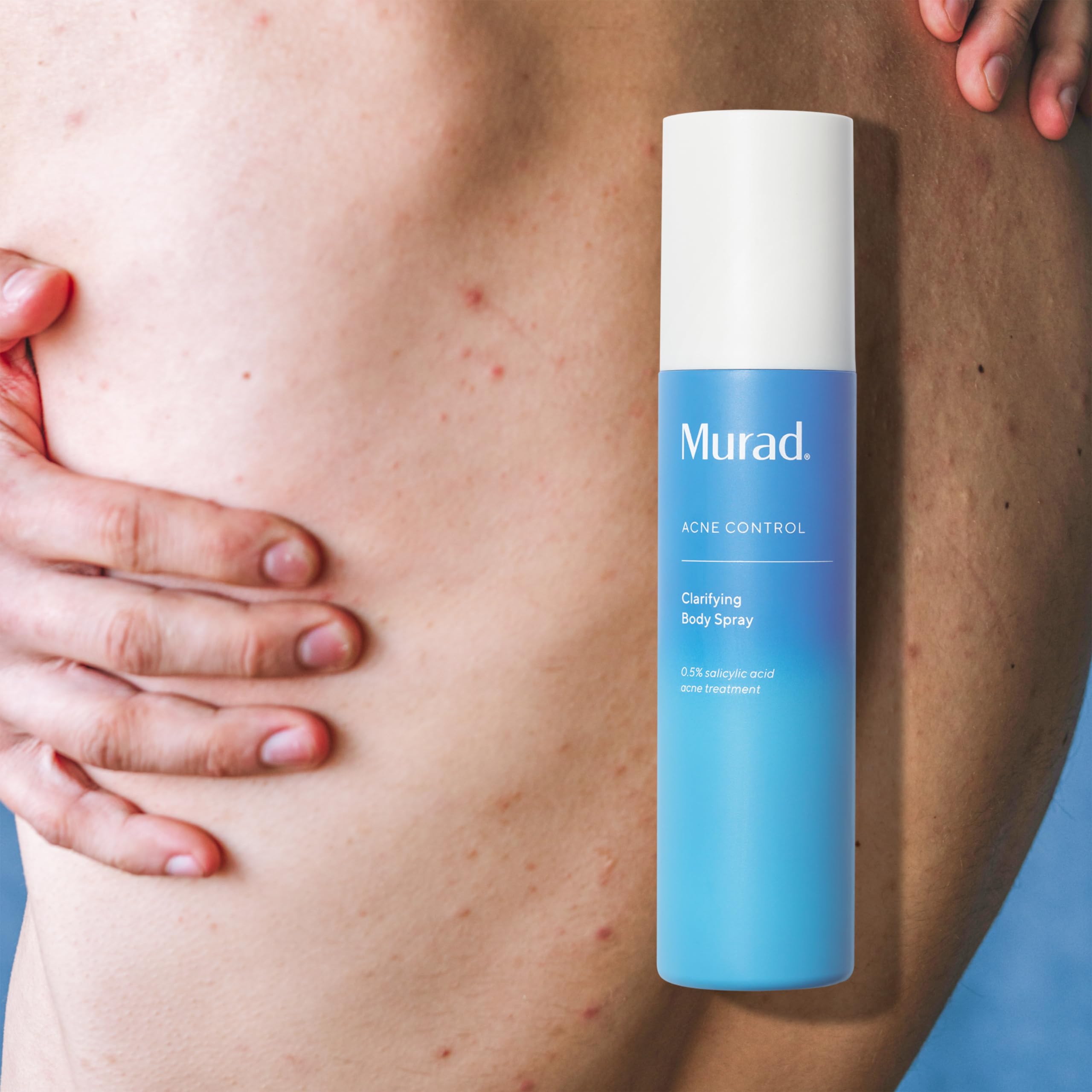 Murad Clarifying Body Spray ciblant les pores et les imperfections corporelles