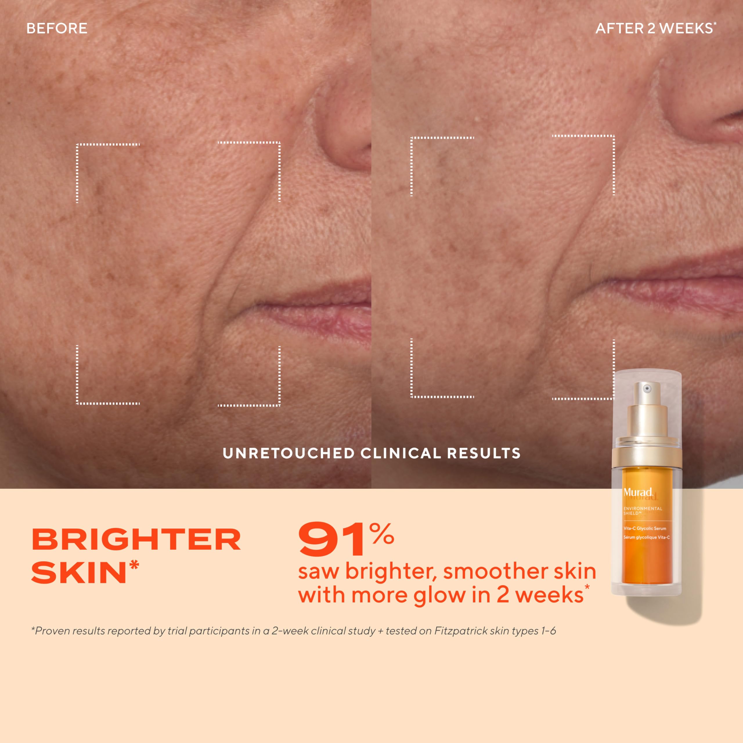 Murad kit éclat: ingrédients clés vitamine C pour routine ciblée.