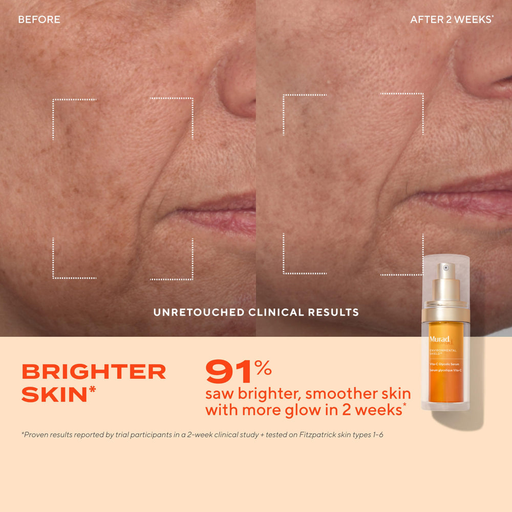 Murad kit éclat: ingrédients clés vitamine C pour routine ciblée.