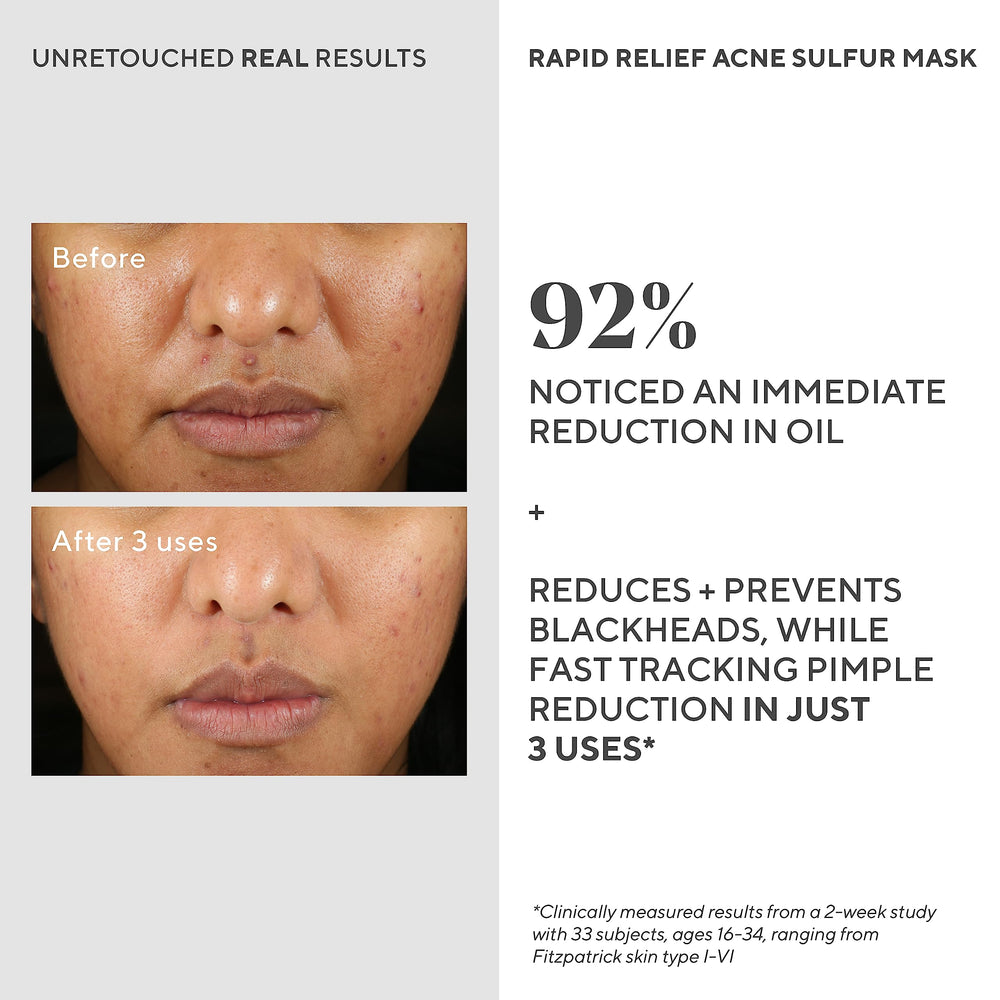 Murad Rapid Relief, purification des pores grâce à l’argile kaolin.