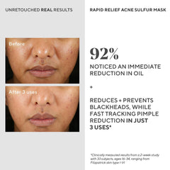 Murad Rapid Relief, purification des pores grâce à l’argile kaolin.