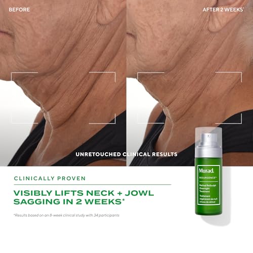 Murad Retinal ReSculpt capsules-retinal-encapsulees apportent une diffusion douce et ciblée.