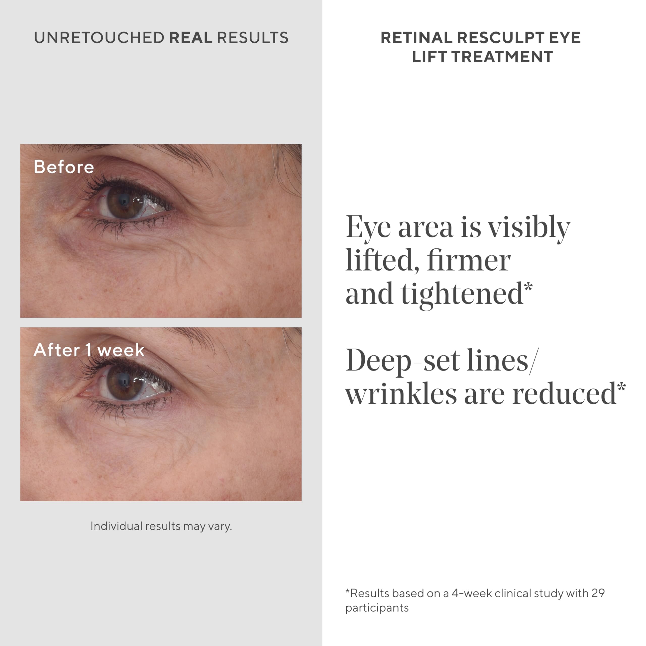 Murad Retinal ReSculpt Eye Lift applique-yeux : apaise et raffermit le contour des yeux.