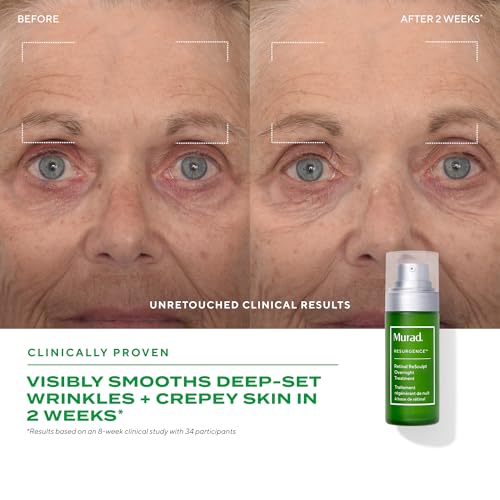 Murad Retinal ReSculpt fleur-patte-kangourou apporte des actifs botaniques nourrissants.