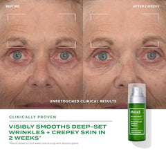 Murad Retinal ReSculpt fleur-patte-kangourou apporte des actifs botaniques nourrissants.