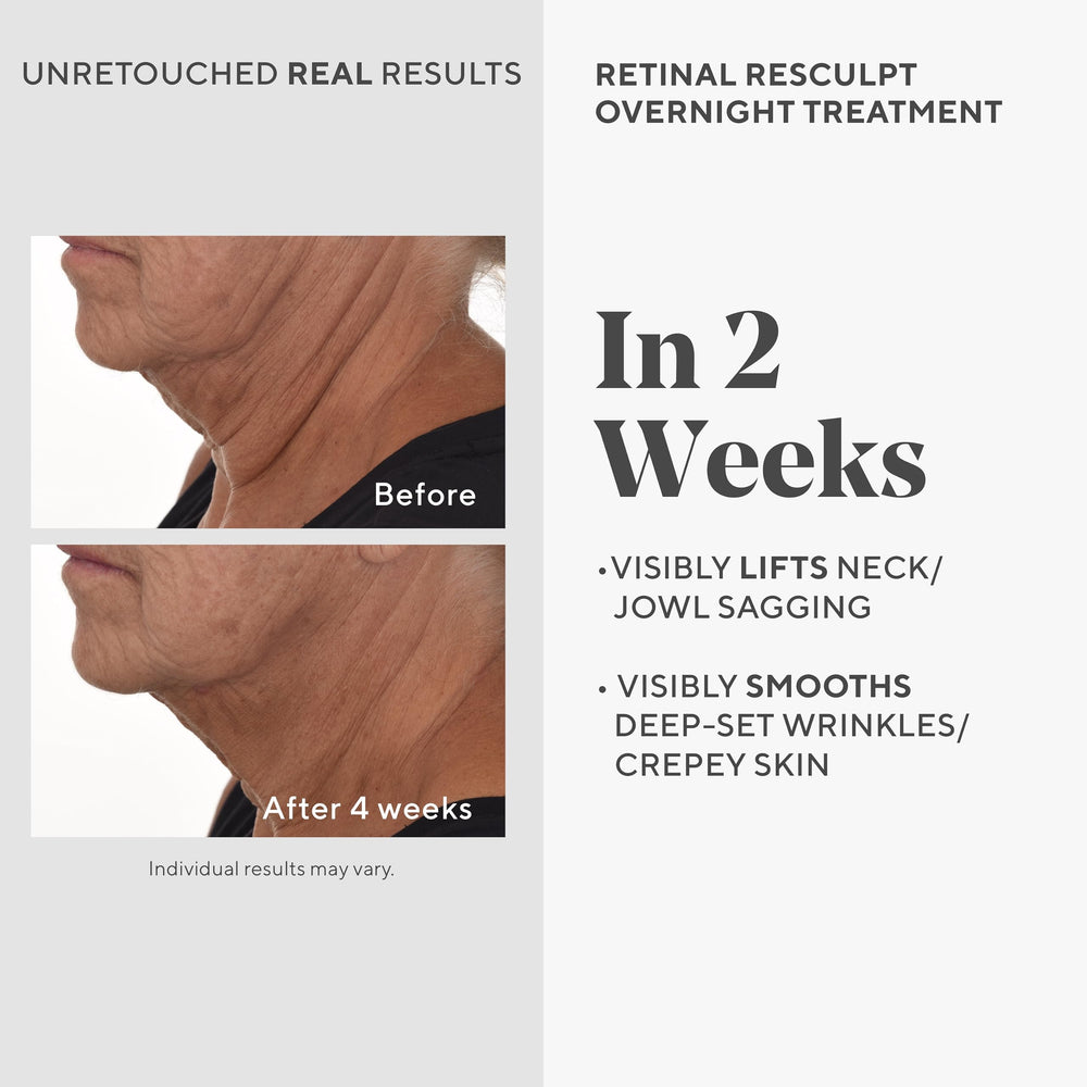 Murad Rétinal ReSculpt Sérum – goutte pratique pour une application nocturne rapide et efficace.