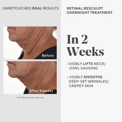 Murad Rétinal ReSculpt Sérum – goutte pratique pour une application nocturne rapide et efficace.