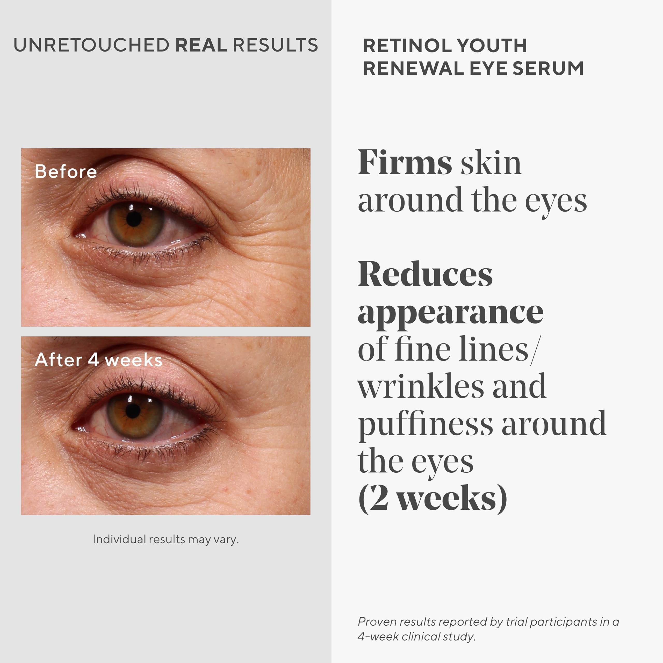 Murad Sérum Yeux Retinol – texture légère après application éclaircissant le regard.