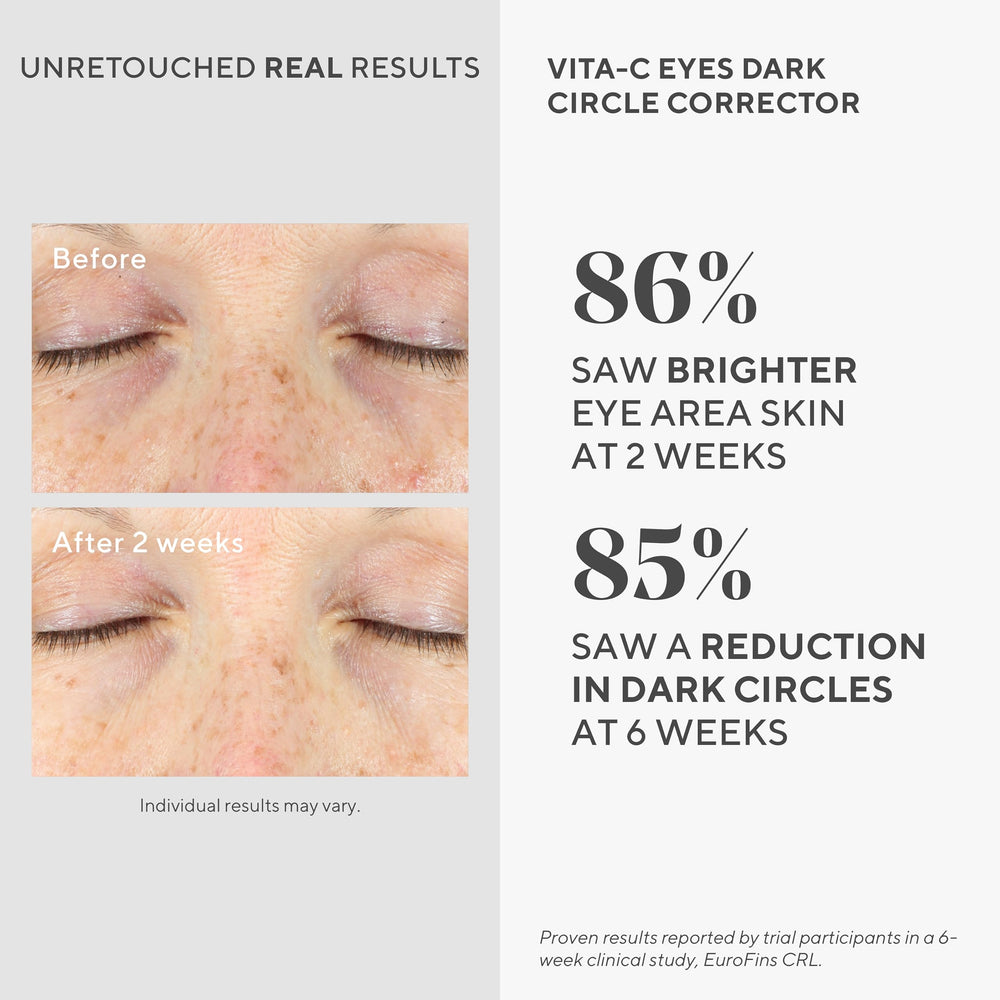 Techniques d'application douce Murad Vita-C Eyes pour réduire l'apparence des cernes et des poches.
