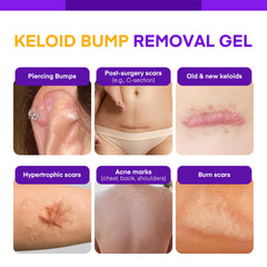 Application sur l’oreille avec le gel keloïde Bump de MURASAKI BEAUTY