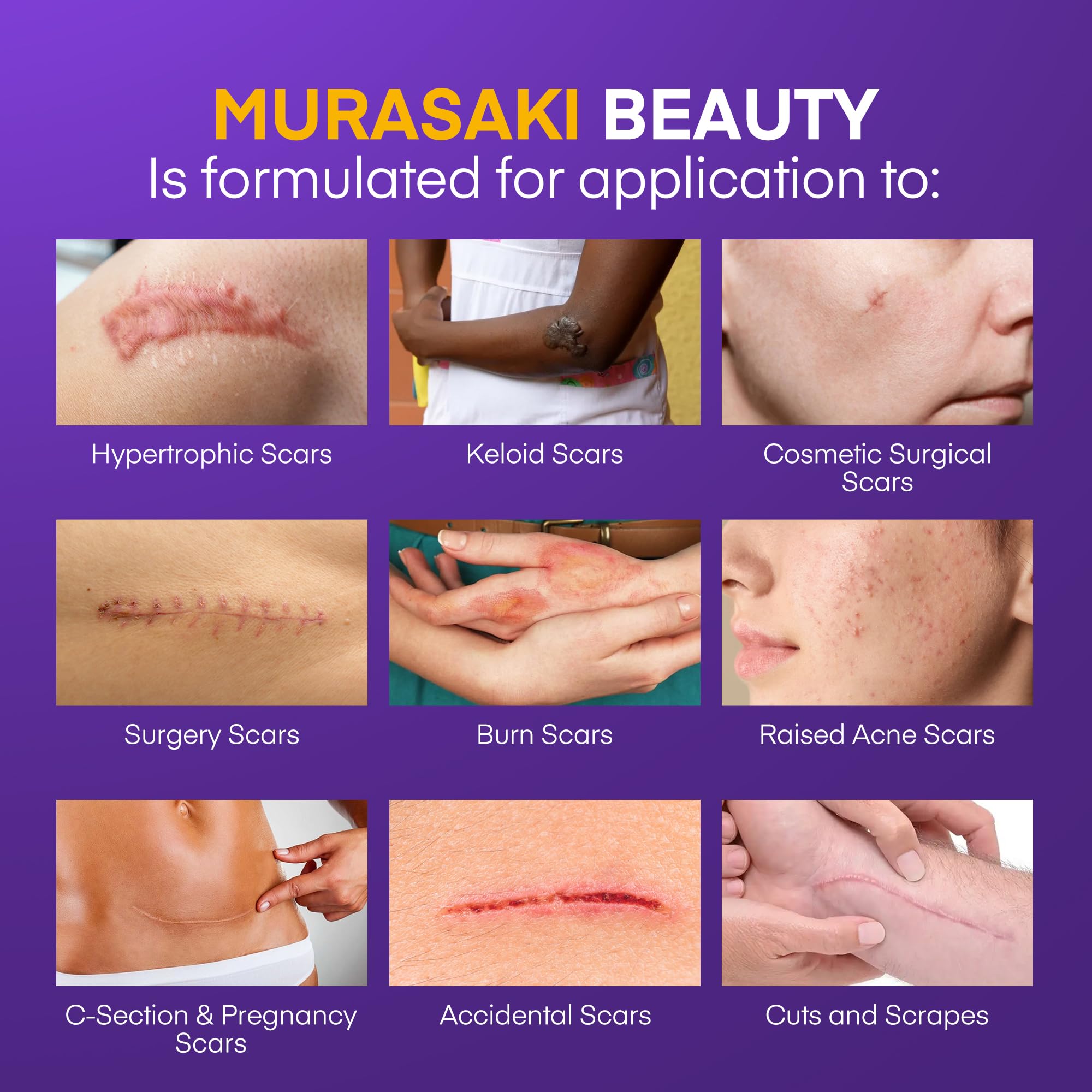 MURASAKI BEAUTY Gel silicone cicatrice, application douce pour lisser texture et couleur