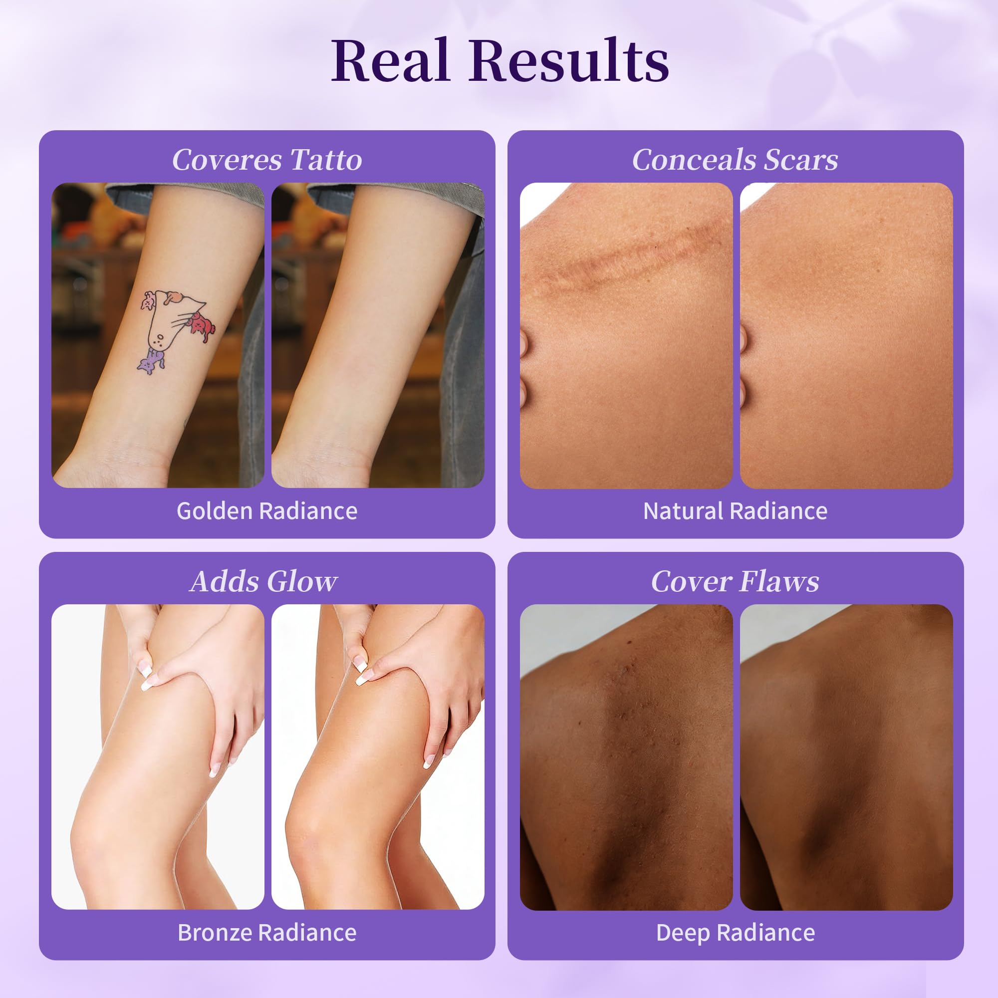 MyTend shade swatches reveal natural tones for tattoos and scars