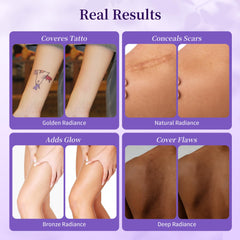 MyTend shade swatches reveal natural tones for tattoos and scars