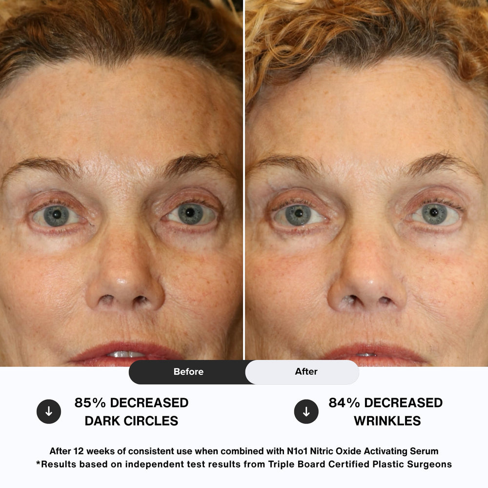 Oxyde nitrique favorisant la pénétration des nutriments autour des yeux.