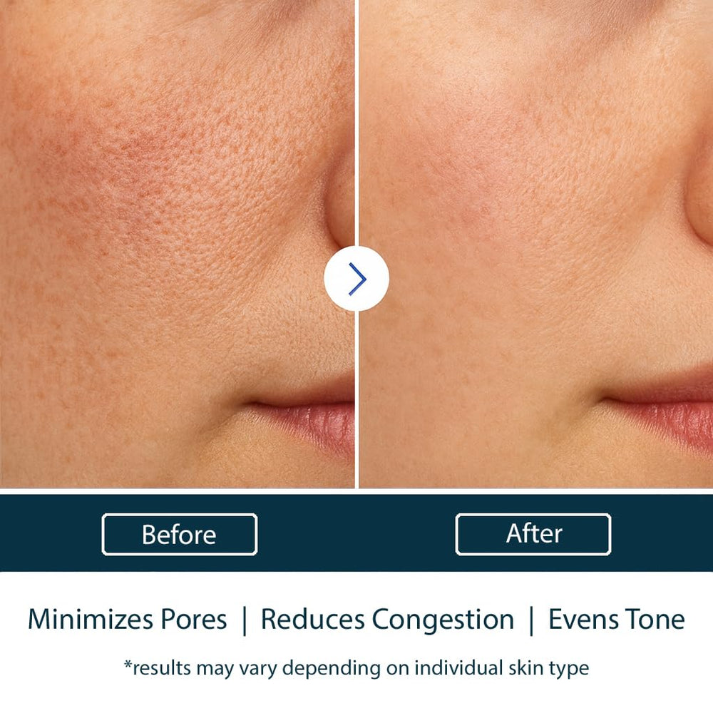 NAELI Texture gel frais prêt à l'application sur le visage.