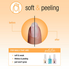 Nail Tek Recovery Kit Strengthen : renforce les ongles et réduit la casse.