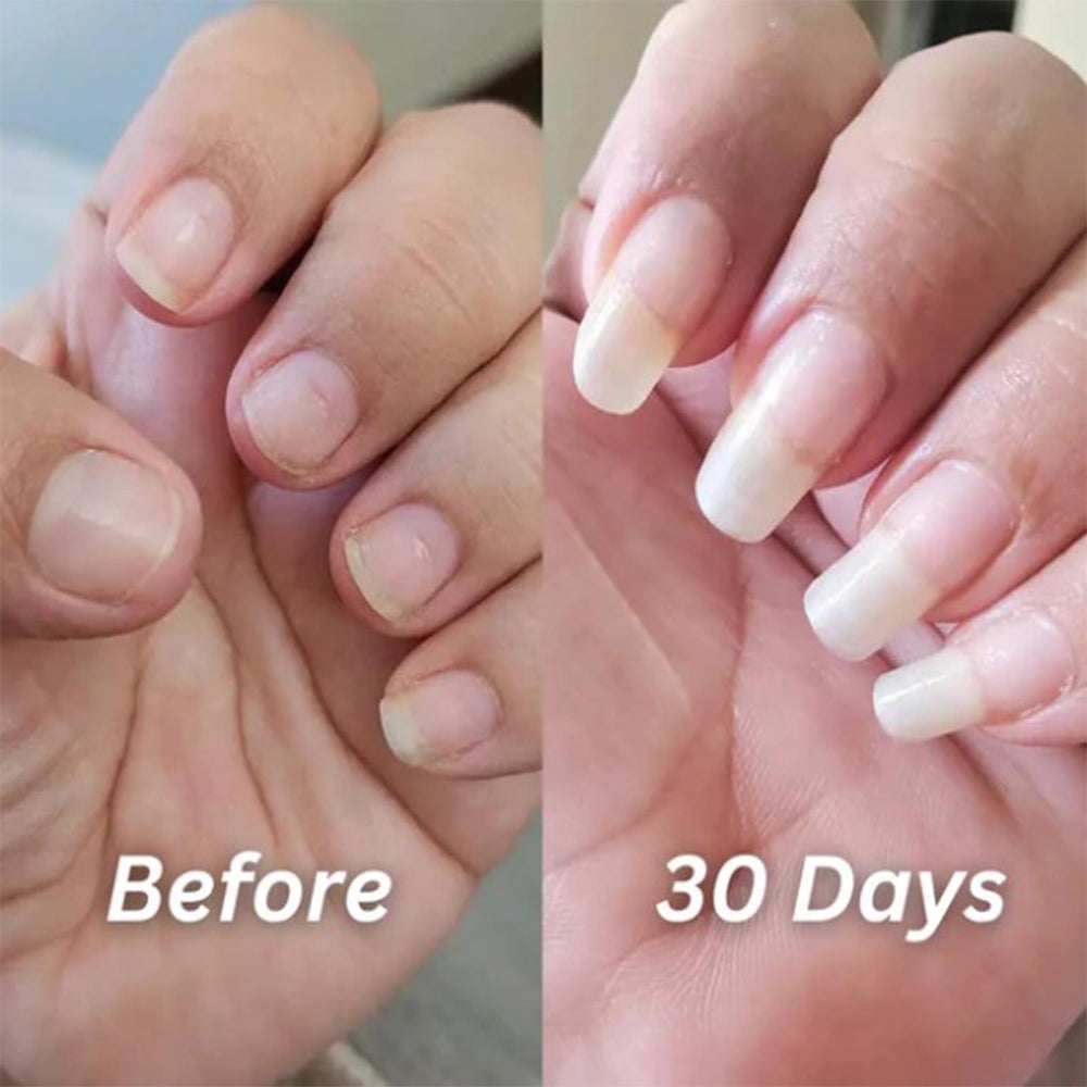 Nailz Stylo Croissance, format compact idéal à transporter.