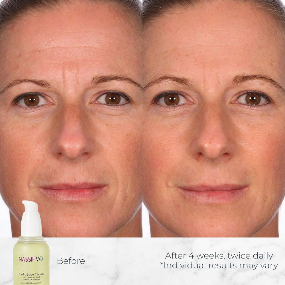 Application du NASSIFMD Hydro-Screen Sérum sur le visage pour une sensation rafraîchissante.