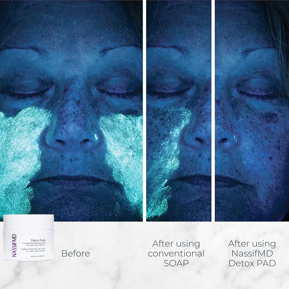 NassifMD lingettes détox, mise en relief des pores pour un visage plus lisse.