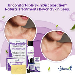 Naturasil Tinea Versicolor Savon barres – détail du savon et texture naturelle.