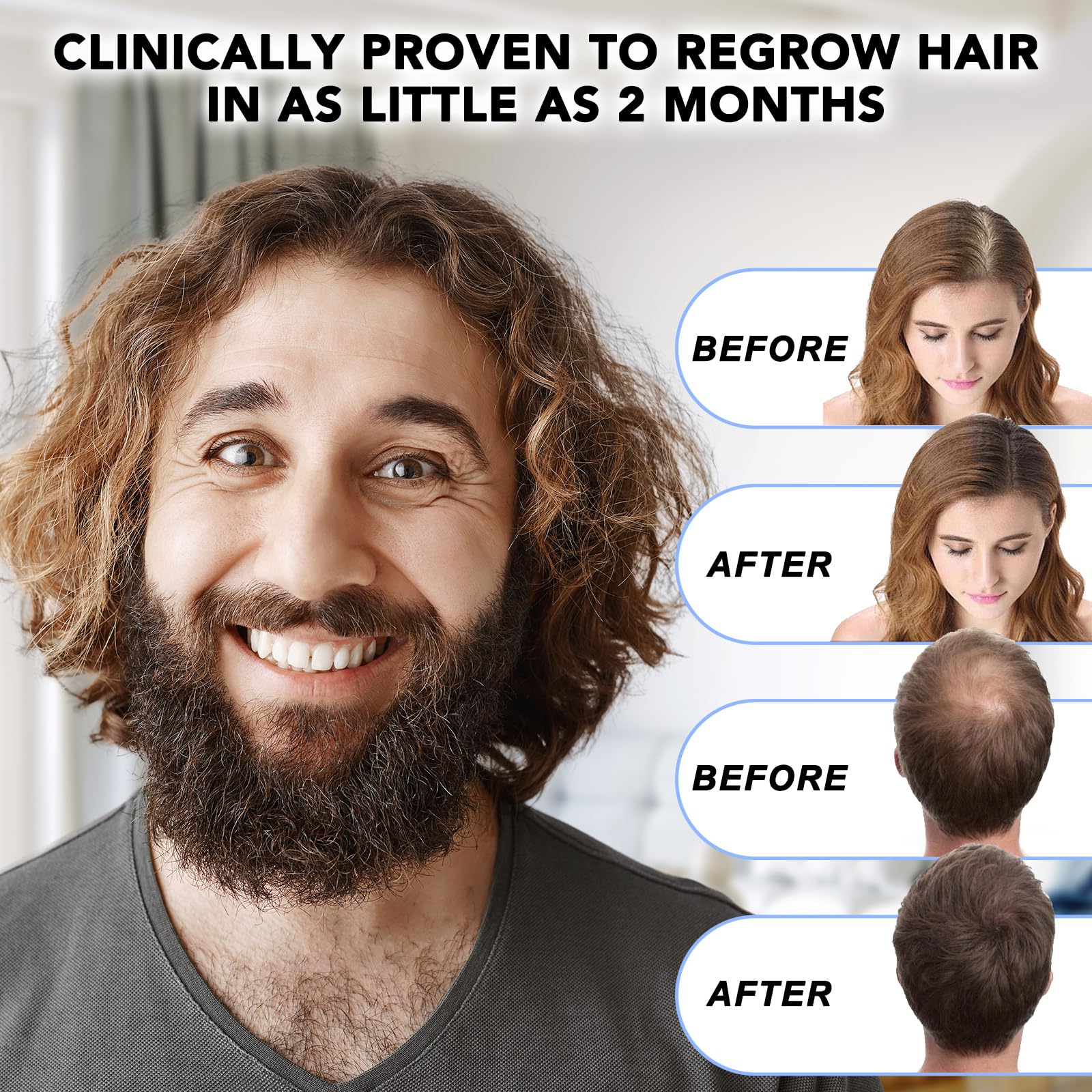 Nature Ziran Minoxidil : application sur le cuir chevelu.
