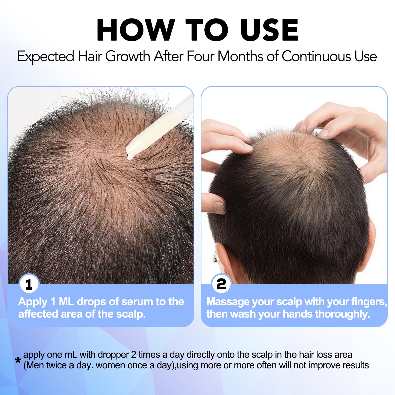 Nature Ziran Minoxidil : usage homme et femme au quotidien.