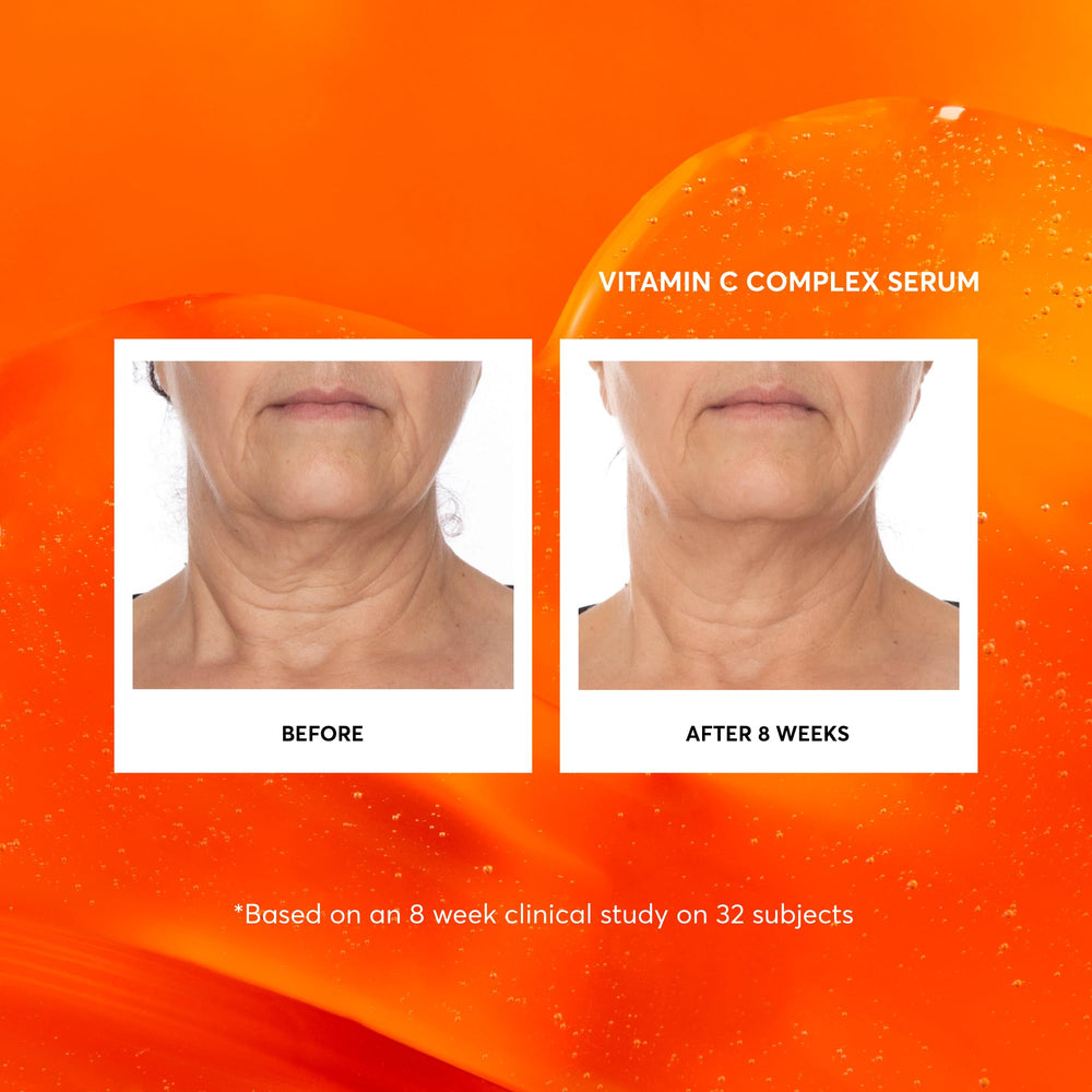 Naturium Sérum vitamine C complexe, emballage format jumbo pour la routine beauté.