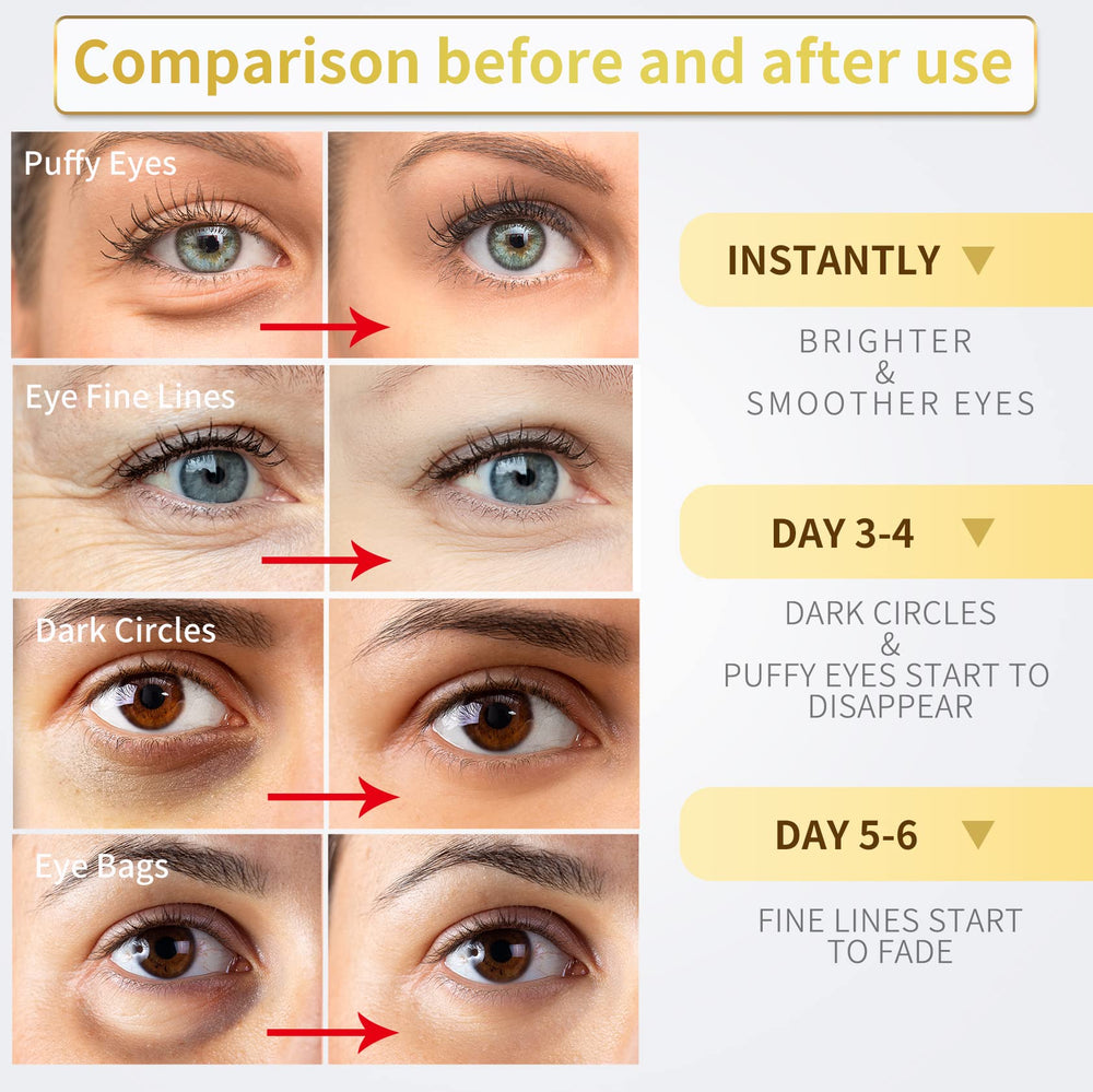NAZANO Or 24K patches yeux application facile et rapide