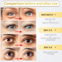 NAZANO Or 24K patches yeux application facile et rapide