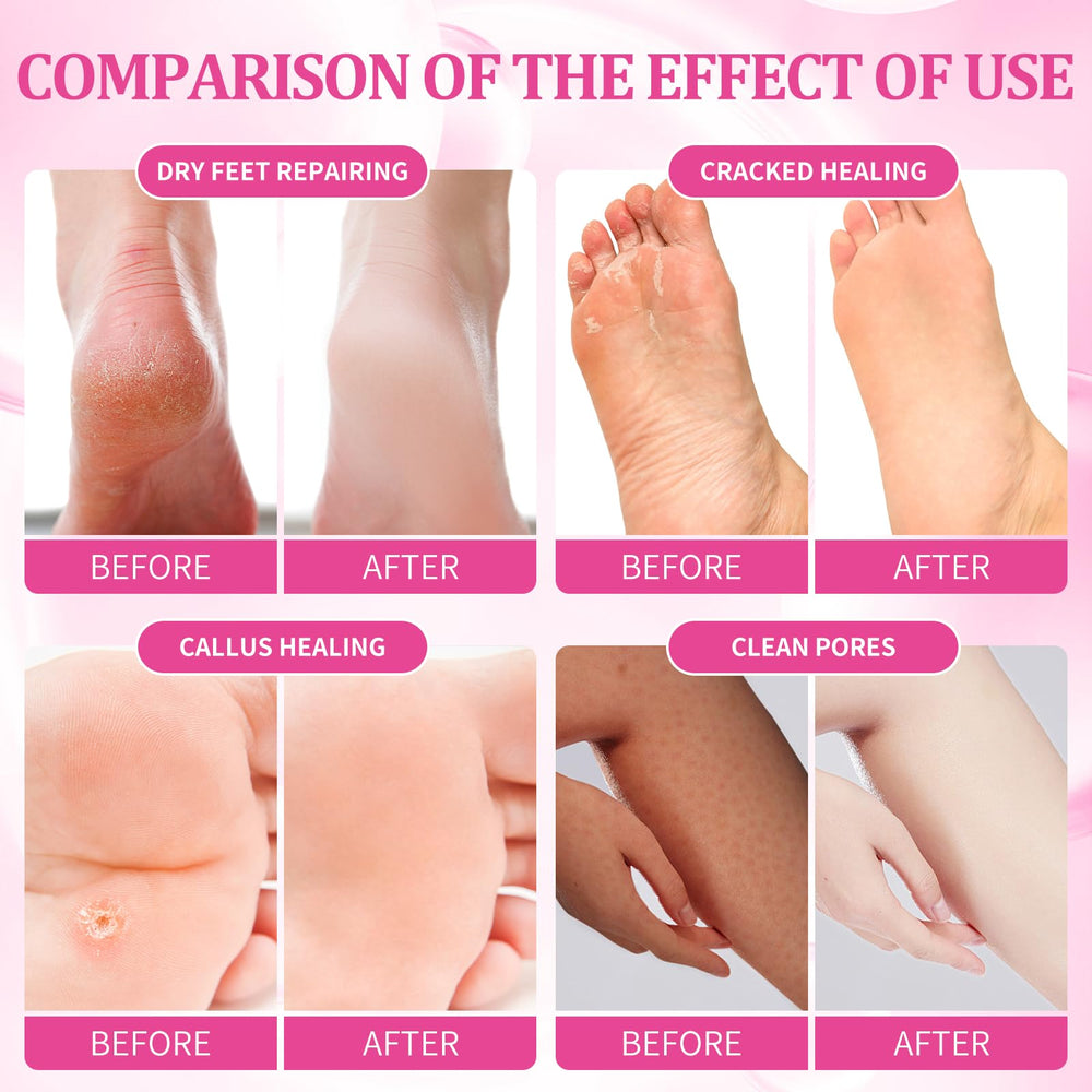 nbc BeautiLab masque-massage-pieds-rose : soin relaxant et doux pour les pieds