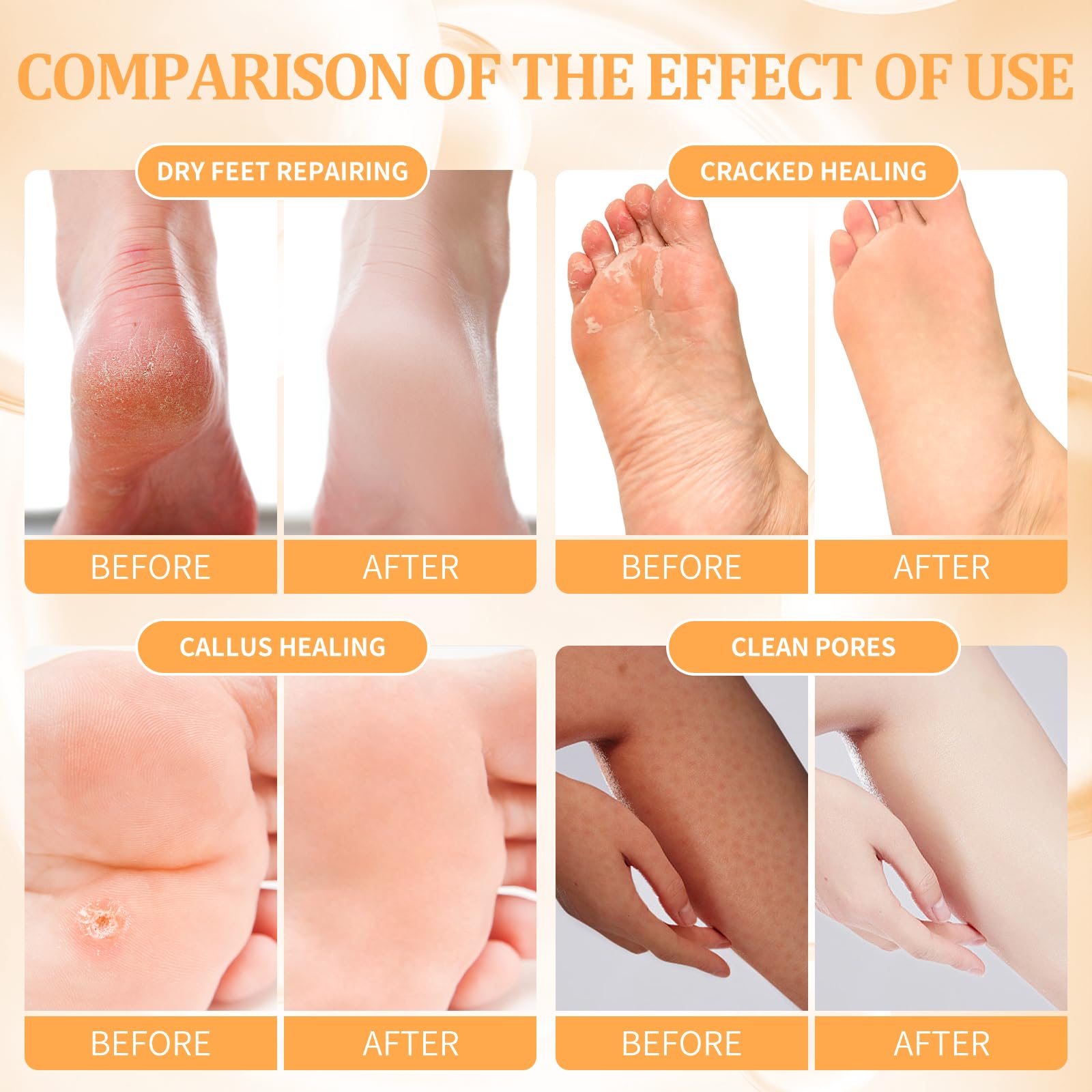 nbc BeautiLab masque-massage-pieds pour une peau plus douce