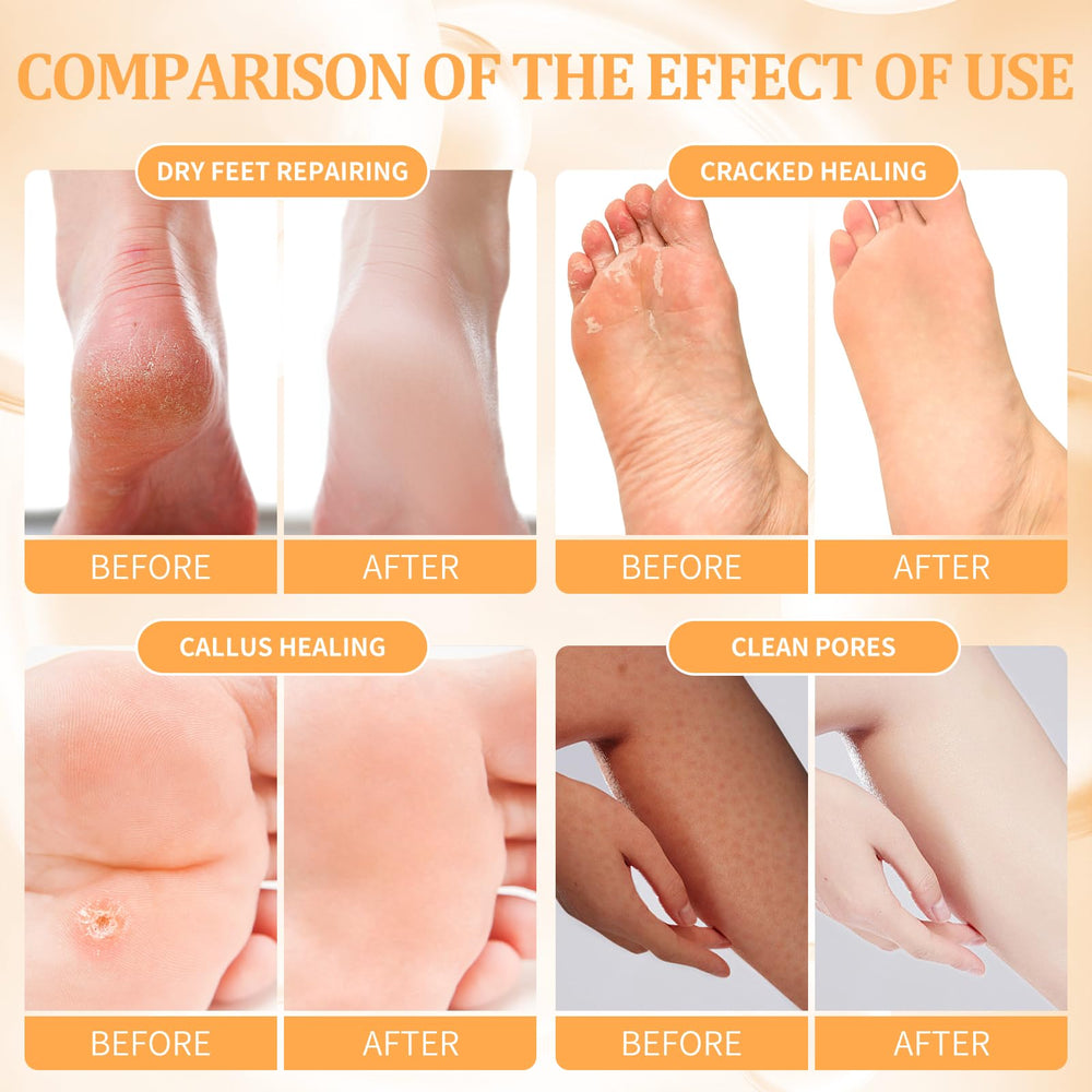 nbc BeautiLab masque-massage-pieds pour une peau plus douce