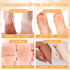 nbc BeautiLab masque-massage-pieds pour une peau plus douce