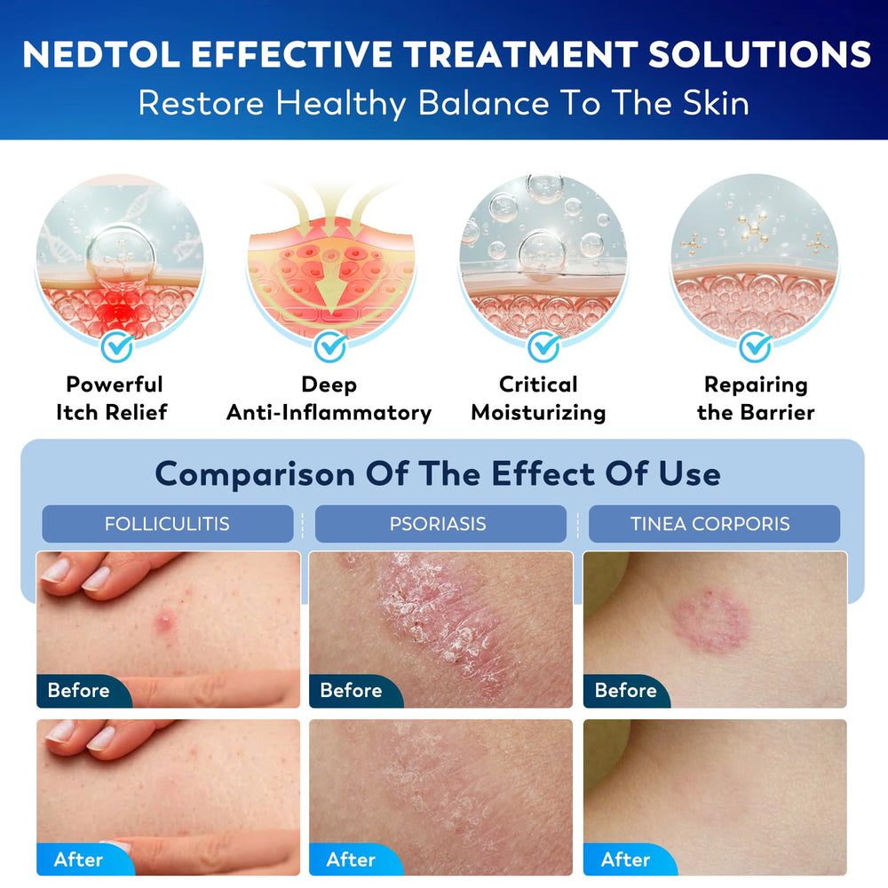 Nedtol Folliculite – emballage 120 g, pratique et hygiénique.