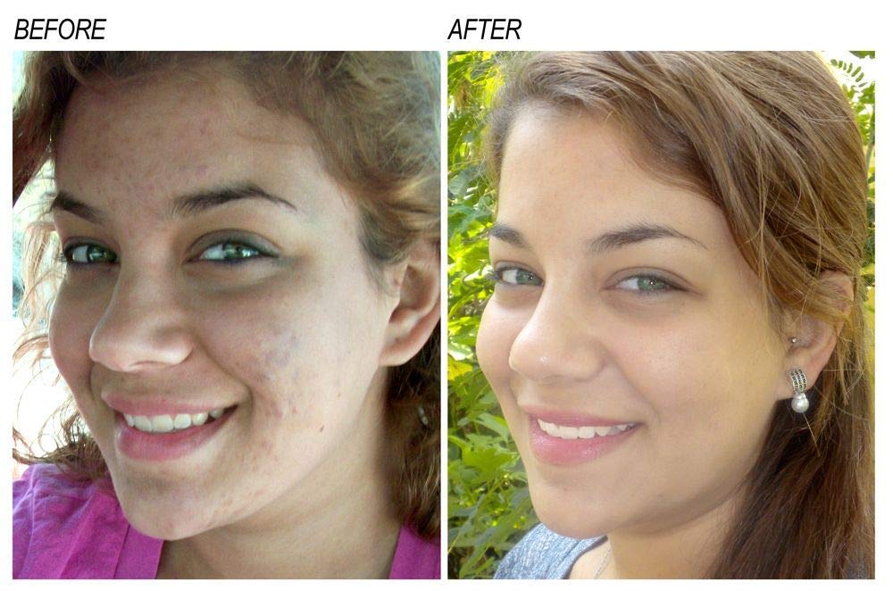 Neoprosone sérum vitamine C, brillance visage, révèle un éclat naturel.