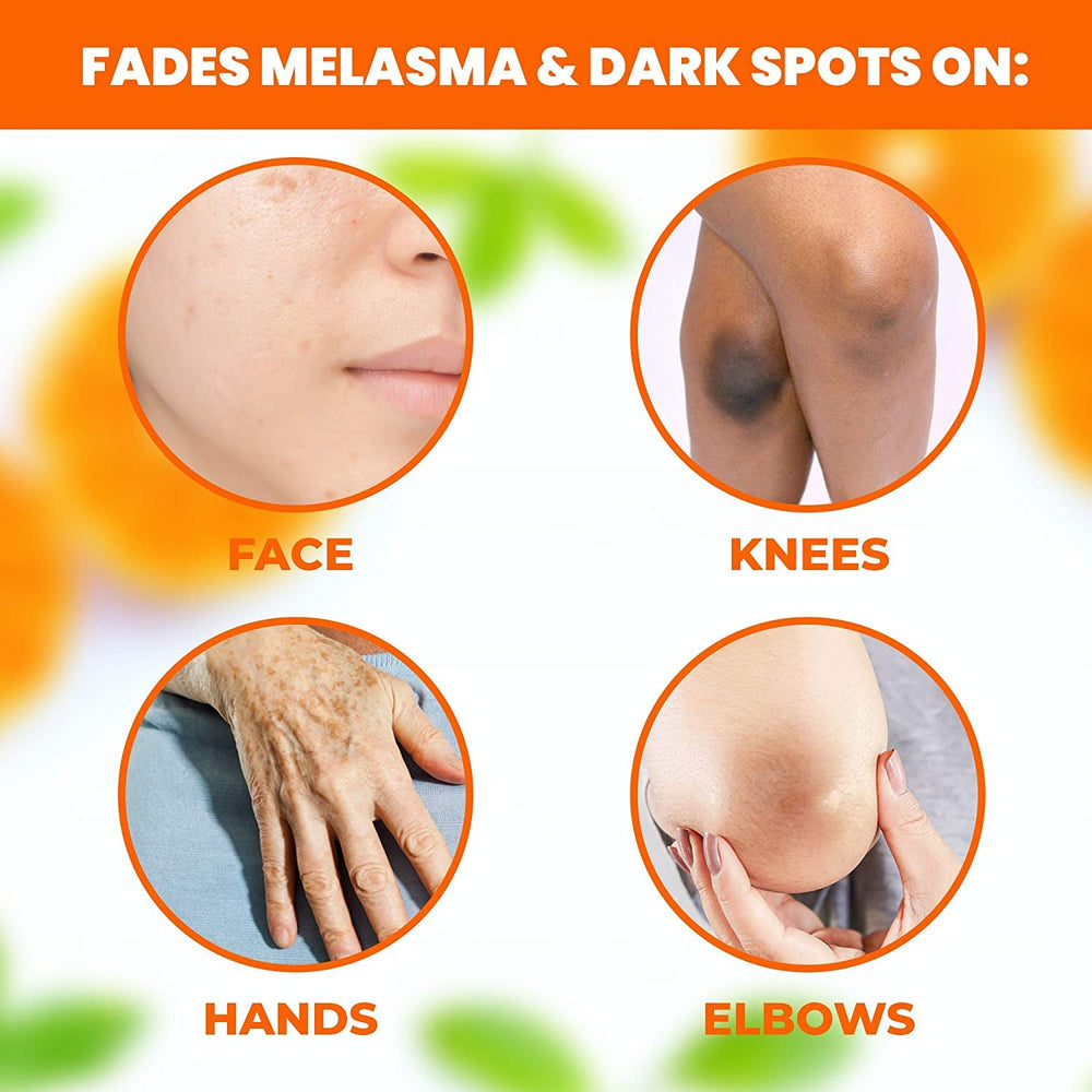 Neoprosone sérum vitamine C, emballage élégant, contenu visuel premium.