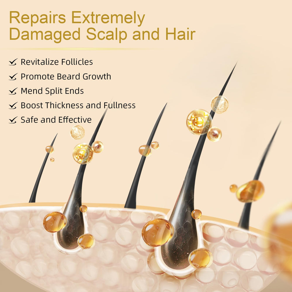 NETYIYUN Minoxidil-serum-biotine-nourrit-cheveux: racines nourries pour une chevelure renforcée