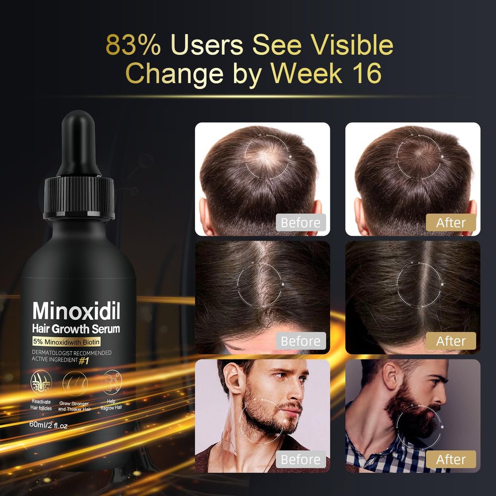 NETYIYUN Minoxidil-serum-etiquette-sans-parabenes-sans-sulfates: formule douce et sans toxines
