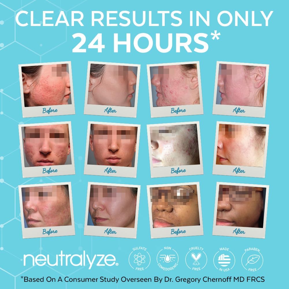 Neutralyze Renewal Complex oil-control technology helps quick absorption.